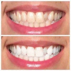 WHITENING TOOTHPASTE THAT WoRkS